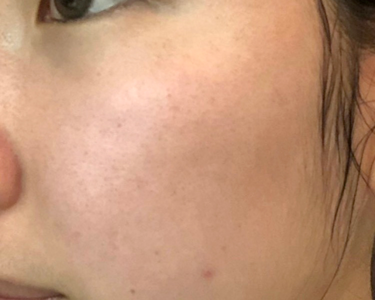 マトリックスエキス　お試し　navis 1日目②